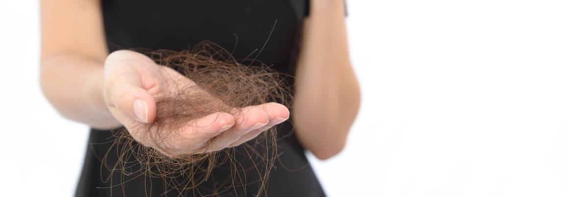 Voiko hormonaalinen epätasapaino aiheuttaa hiustenlähtöä naisilla?