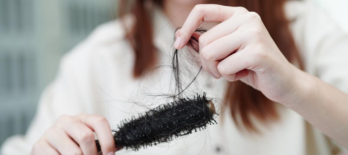 Aliravitsemus voi johtaa hiustenlähtöön - Mutta se on usein palautettavissa oikealla ravitsemuksella.