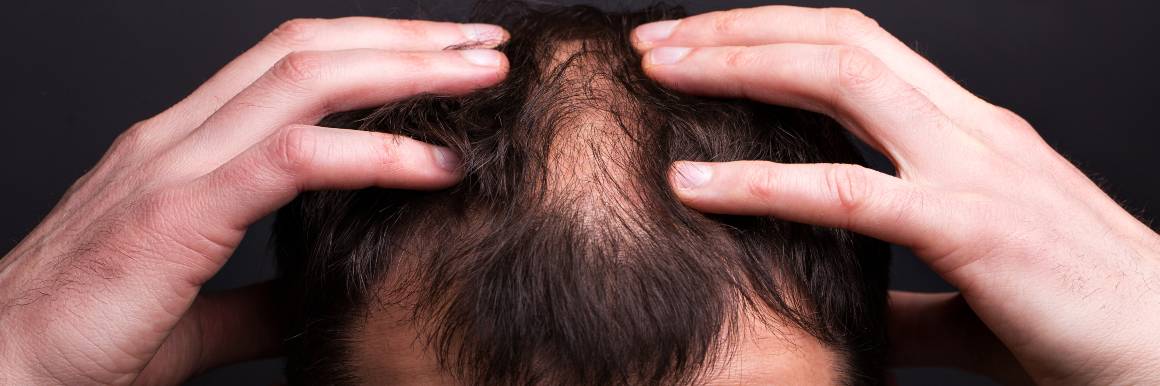 Vahingoittuneiden karvatupien korjaaminen terveen hiusten kasvun varmistamiseksi